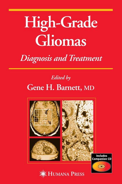 Produktbild: High-Grade Gliomas