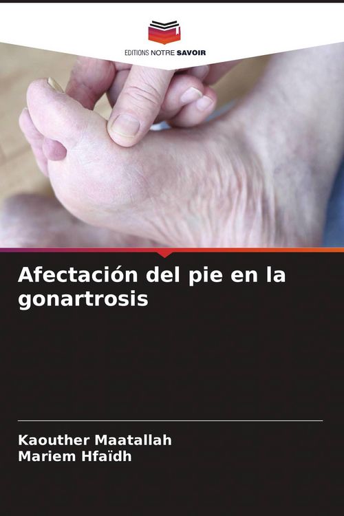 Produktbild: Afectaci&oacute;n del pie en la gonartrosis