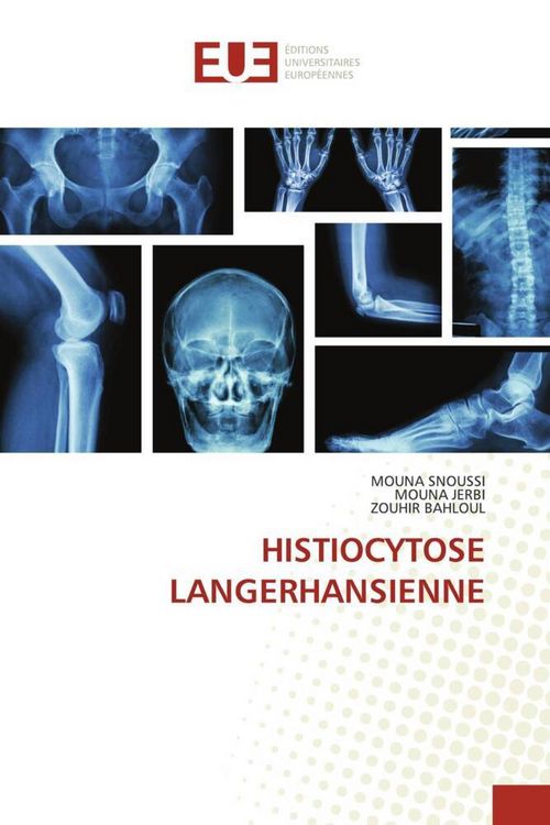 Produktbild: Histiocytose Langerhansienne