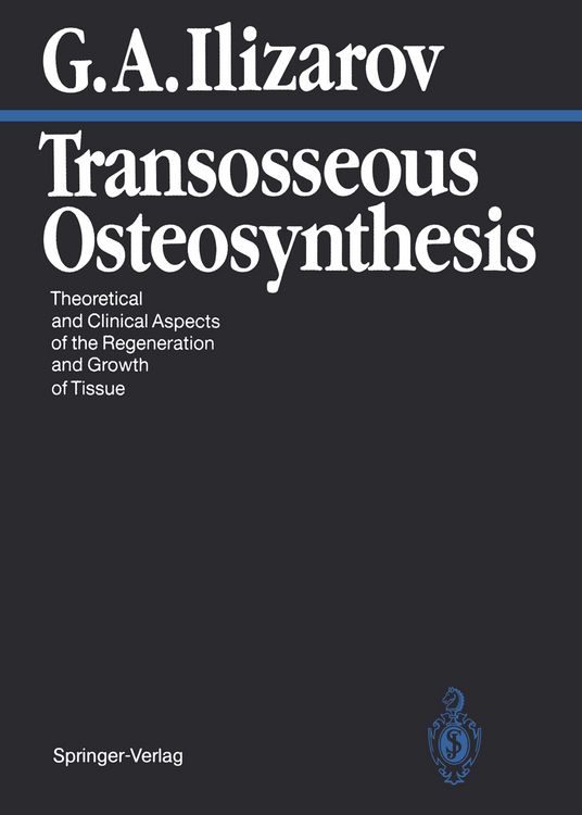 Produktbild: Transosseous Osteosynthesis
