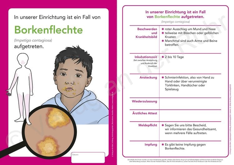Produktbild: Erg&auml;nzungsset: Achtung, Ansteckungsgefahr! &ndash; 8 weitere Aush&auml;nge und Merkbl&auml;tter zu &uuml;bertragbaren Krankheiten