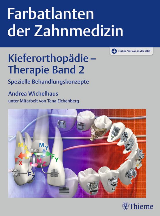 Produktbild: Kieferorthop&auml;die - Therapie Band 2
