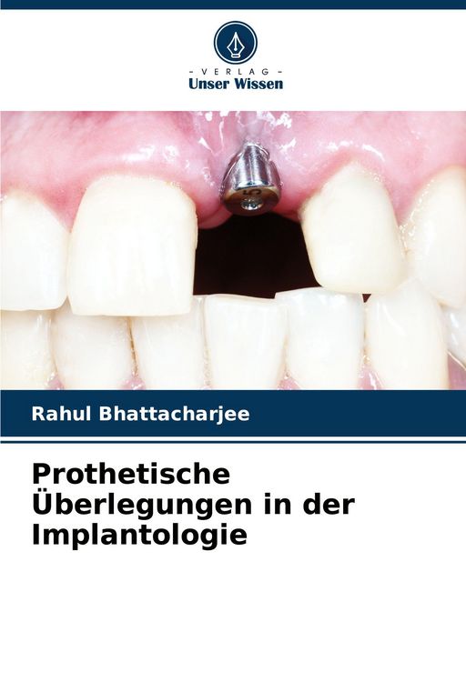 Produktbild: Prothetische &Uuml;berlegungen in der Implantologie