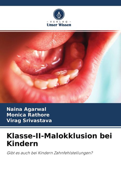 Produktbild: Klasse-II-Malokklusion bei Kindern
