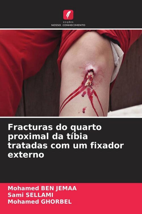 Produktbild: Fracturas do quarto proximal da t&iacute;bia tratadas com um fixador externo