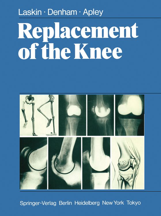 Produktbild: Replacement of the Knee