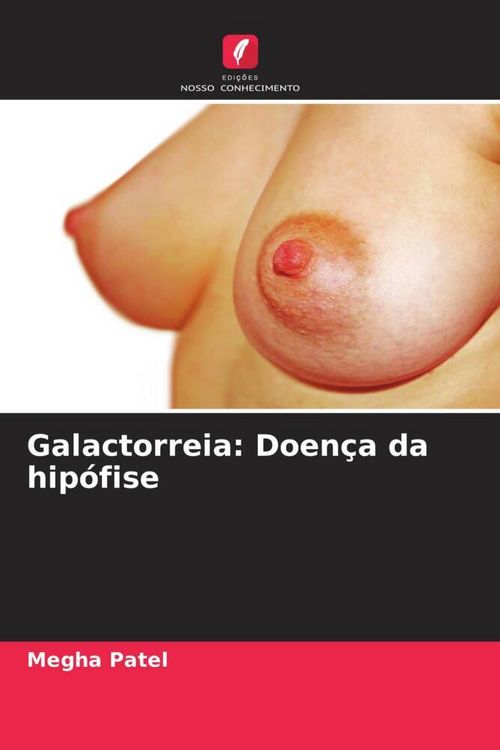 Produktbild: Galactorreia: Doen&ccedil;a da hip&oacute;fise