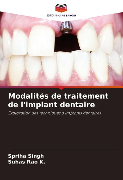 Produktbild: Modalit&eacute;s de traitement de l'implant dentaire