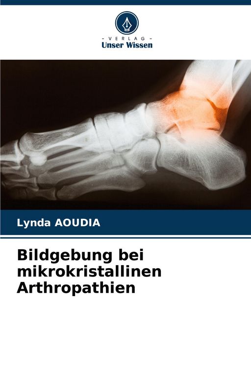 Produktbild: Bildgebung bei mikrokristallinen Arthropathien