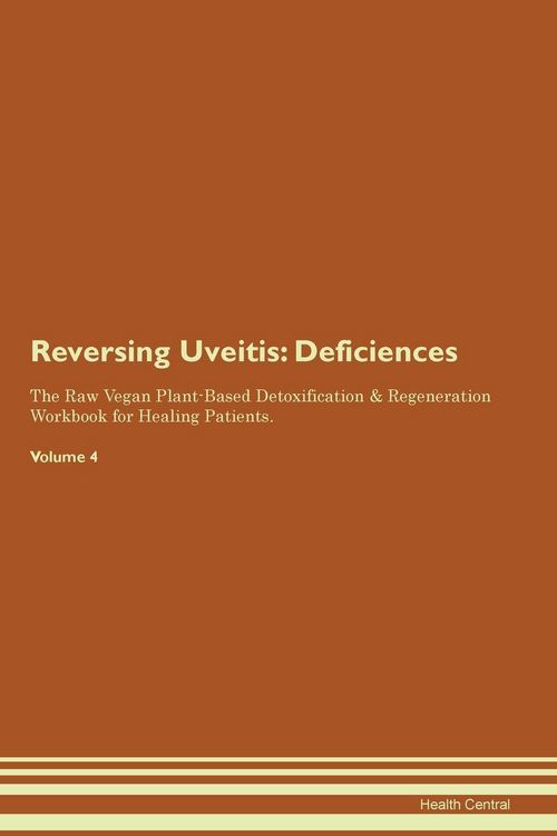 Produktbild: Reversing Uveitis
