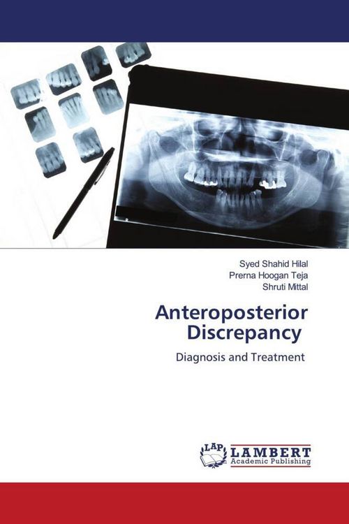 Produktbild: Anteroposterior Discrepancy