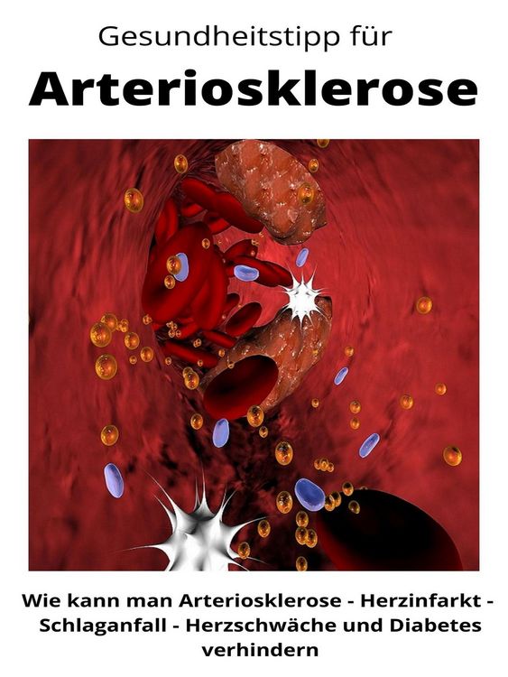 Produktbild: Gesundheitstipp f&uuml;r Arteriosklerose
