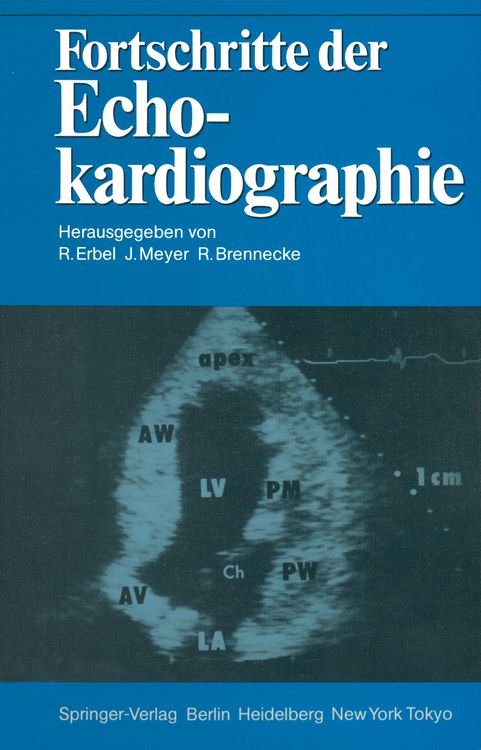 Produktbild: Fortschritte der Echokardiographie