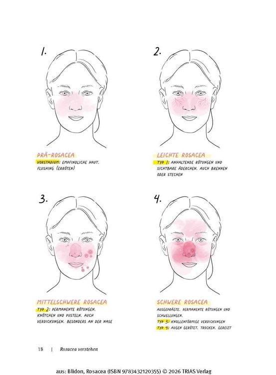 Produktbild: Rosacea
