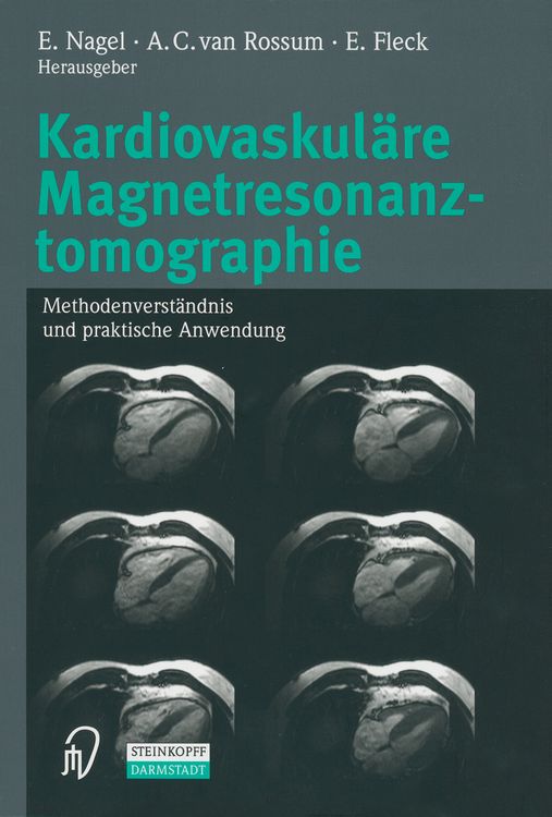 Produktbild: Kardiovaskul&auml;re Magnetresonanztomographie