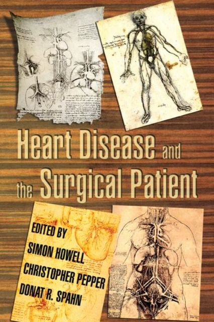 Produktbild: Heart Disease and the Surgical Patient