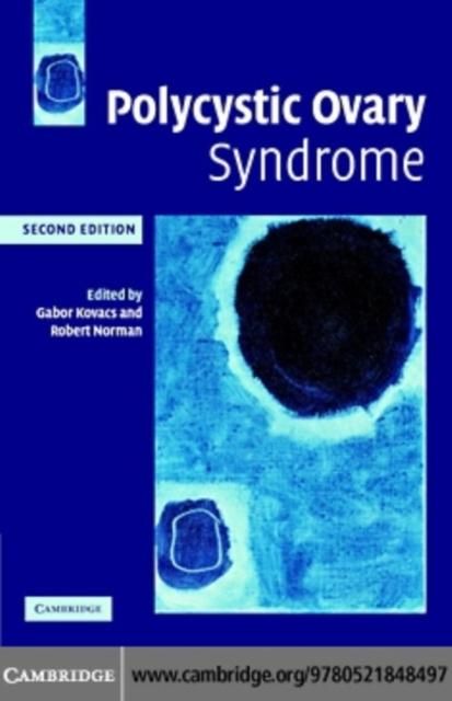 Produktbild: Polycystic Ovary Syndrome