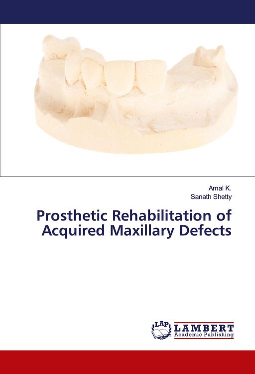 Produktbild: Prosthetic Rehabilitation of Acquired Maxillary Defects