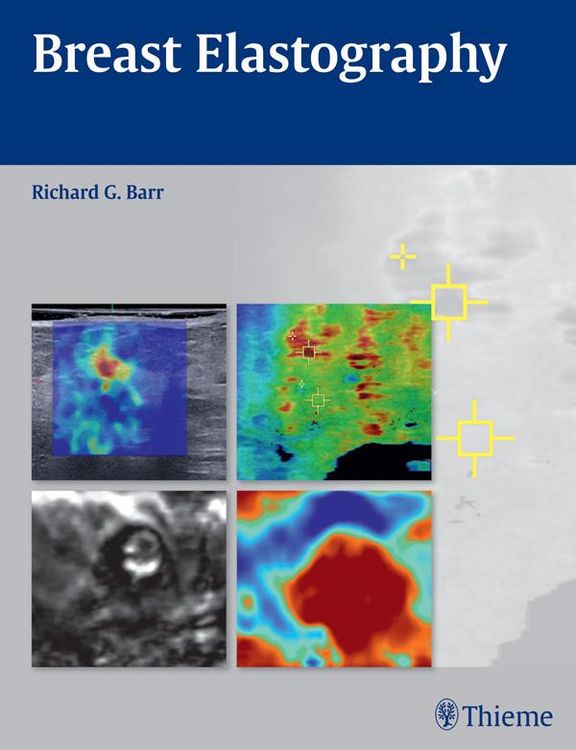 Produktbild: Breast Elastography