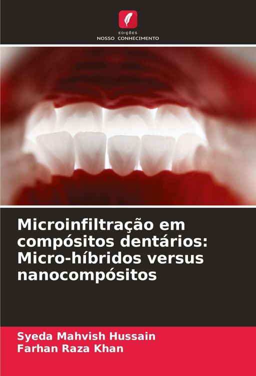 Produktbild: Microinfiltra&ccedil;&atilde;o em comp&oacute;sitos dent&aacute;rios: Micro-h&iacute;bridos versus nanocomp&oacute;sitos