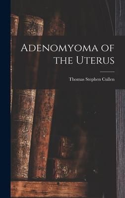Produktbild: Adenomyoma of the Uterus