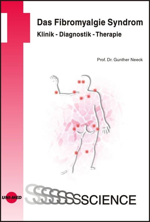 Produktbild: Das Fibromyalgie Syndrom. Klinik - Diagnostik - Therapie