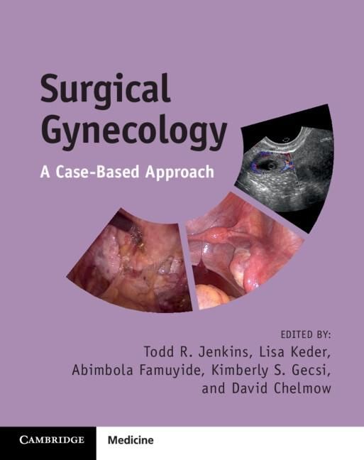 Produktbild: Surgical Gynecology