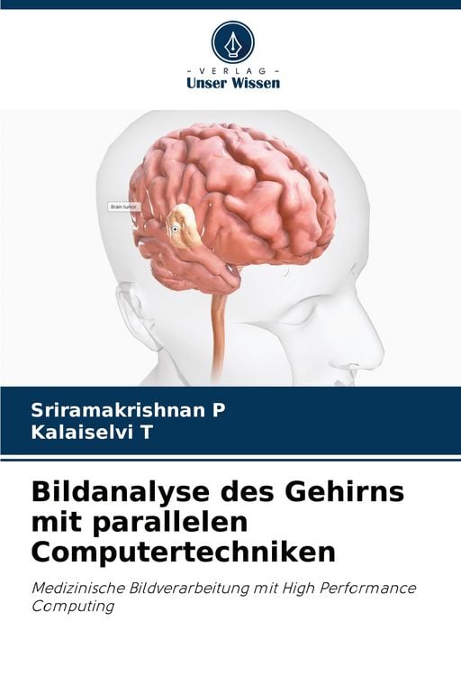 Produktbild: Bildanalyse des Gehirns mit parallelen Computertechniken