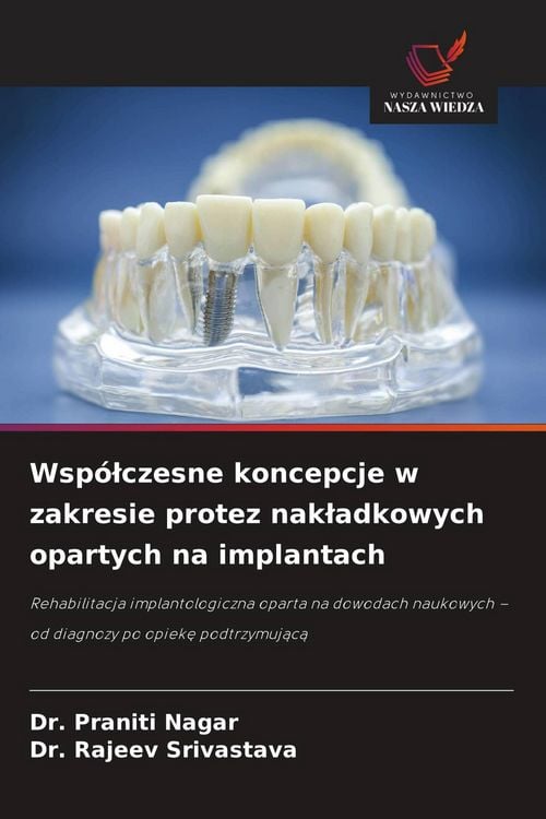 Produktbild: Wsp&oacute;&iquest;czesne koncepcje w zakresie protez nak&iquest;adkowych opartych na implantach