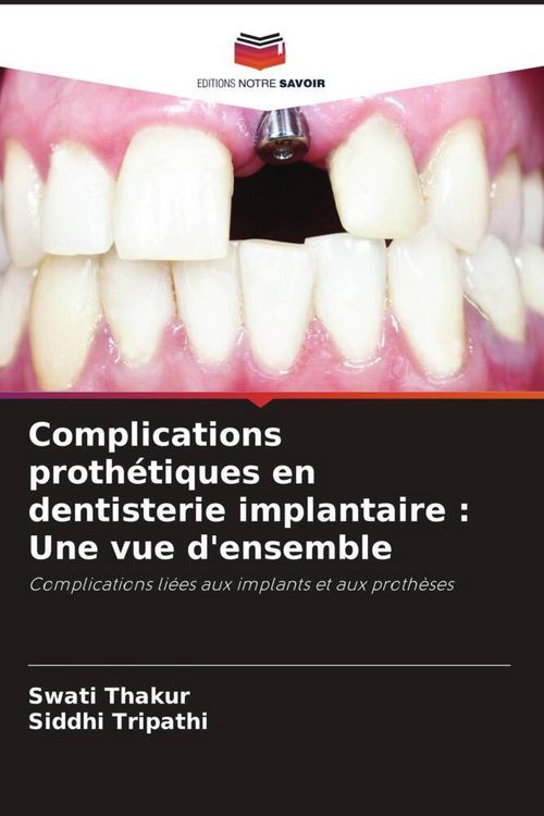 Produktbild: Complications proth&eacute;tiques en dentisterie implantaire : Une vue d'ensemble