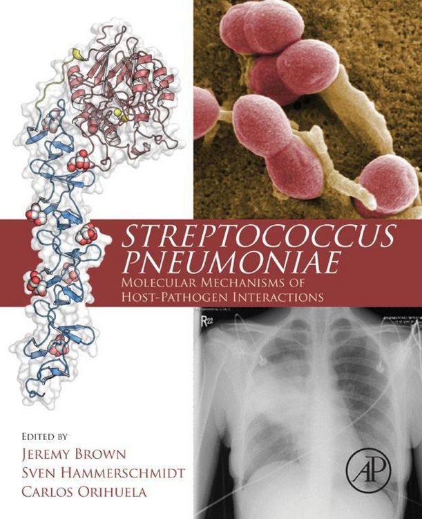 Produktbild: Streptococcus Pneumoniae