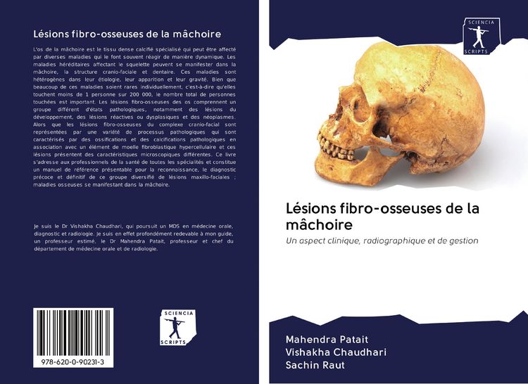 Produktbild: L&eacute;sions fibro-osseuses de la m&acirc;choire