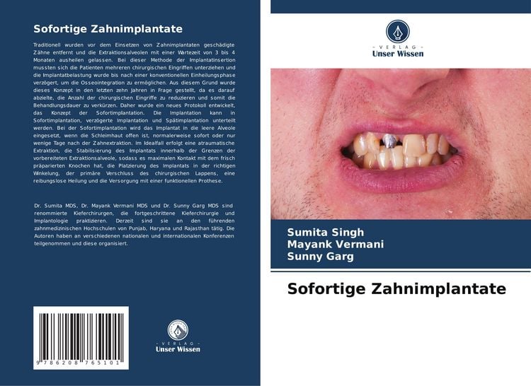 Produktbild: Sofortige Zahnimplantate