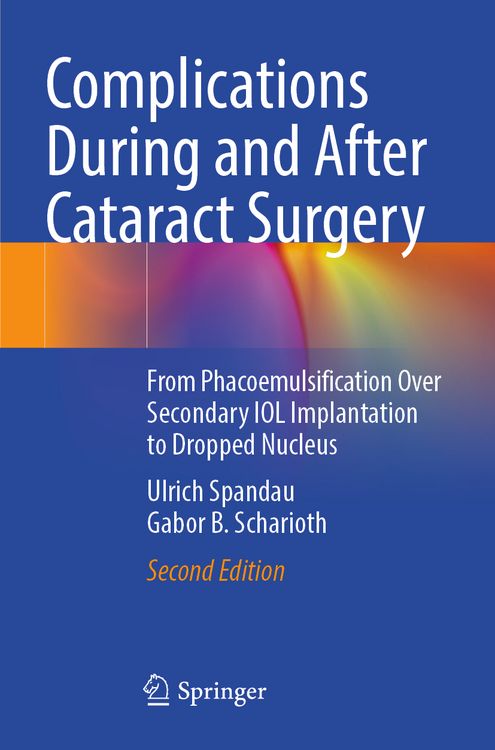 Produktbild: Complications During and After Cataract Surgery