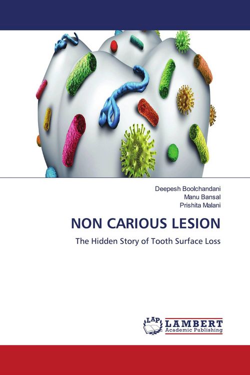 Produktbild: Non Carious Lesion