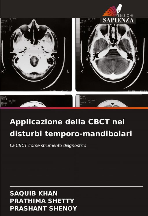 Produktbild: Applicazione della CBCT nei disturbi temporo-mandibolari