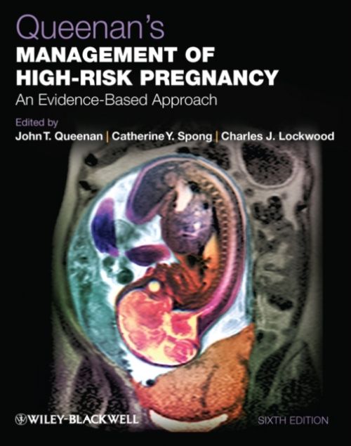 Produktbild: Queenan's Management of High-Risk Pregnancy