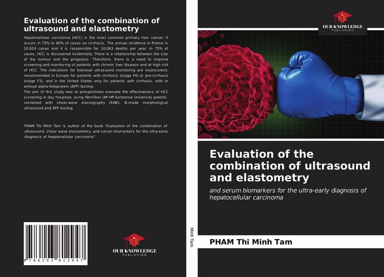 Produktbild: Evaluation of the combination of ultrasound and elastometry