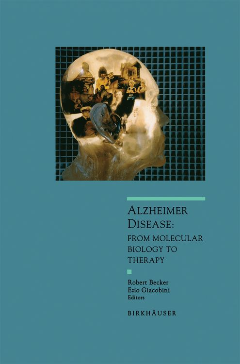 Produktbild: Alzheimer Disease