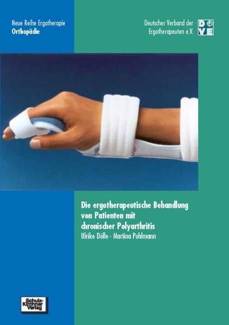 Produktbild: Die ergotherapeutische Behandlung von Patienten mit chronischer Polyarthritis