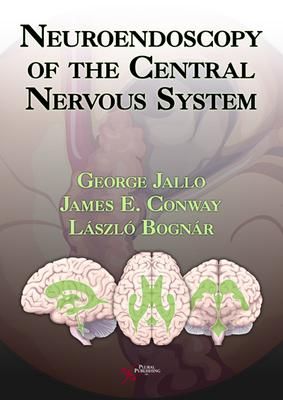 Produktbild: Neuroendoscopy of the Central Nervous System