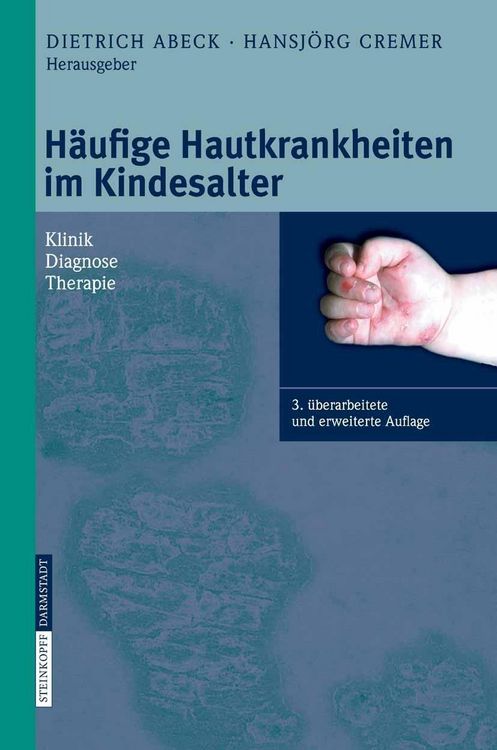 Produktbild: H&auml;ufige Hautkrankheiten im Kindesalter