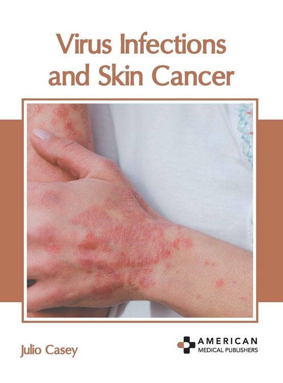Produktbild: Virus Infections and Skin Cancer