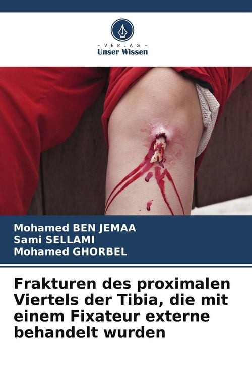 Produktbild: Frakturen des proximalen Viertels der Tibia, die mit einem Fixateur externe behandelt wurden