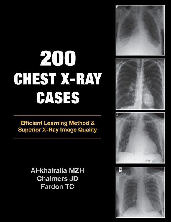 Produktbild: 200 Chest X-Ray Cases