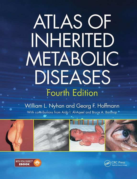 Produktbild: Atlas of Inherited Metabolic Diseases