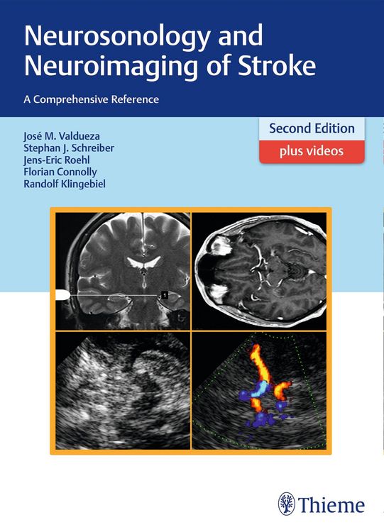 Produktbild: Neurosonology and Neuroimaging of Stroke