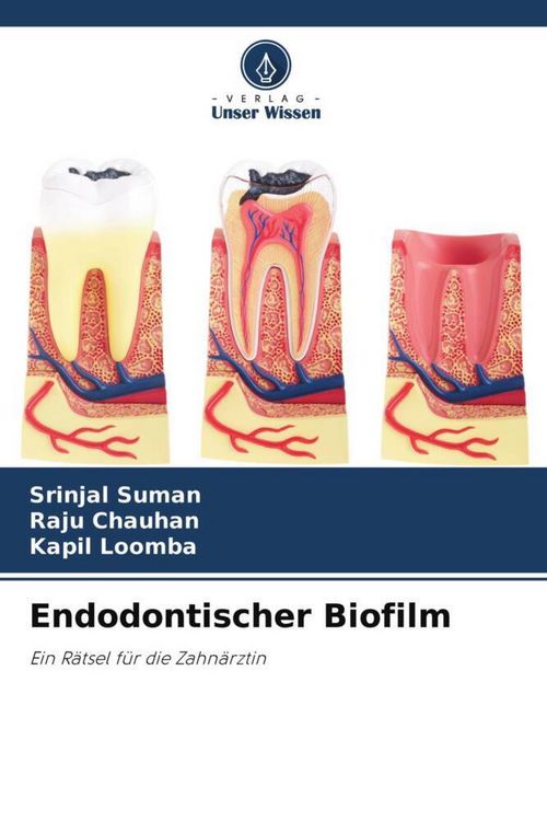 Produktbild: Endodontischer Biofilm
