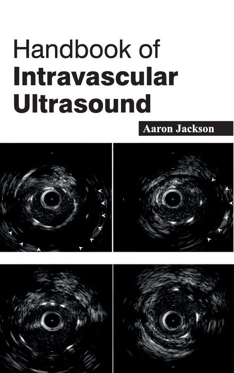 Produktbild: Handbook of Intravascular Ultrasound