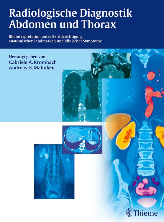 Produktbild: Radiologische Diagnostik Abdomen und Thorax